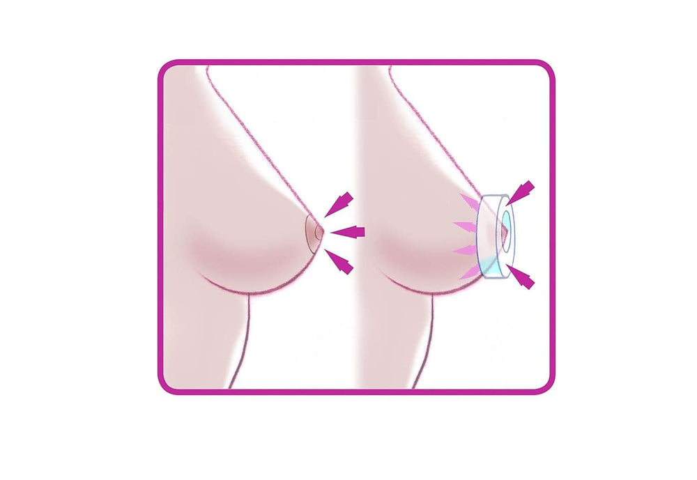 ELANEE Brust-Ringe, Schutz Der Brustwarze Bh-Kontakt Durch Hohllagerung, Ideal Bei Wunden, Entzündeten Brustwarzen Durch Stillen, 10 Stück (222-00) Příslušenství Jídlo a kojení Bebe Naty Shop