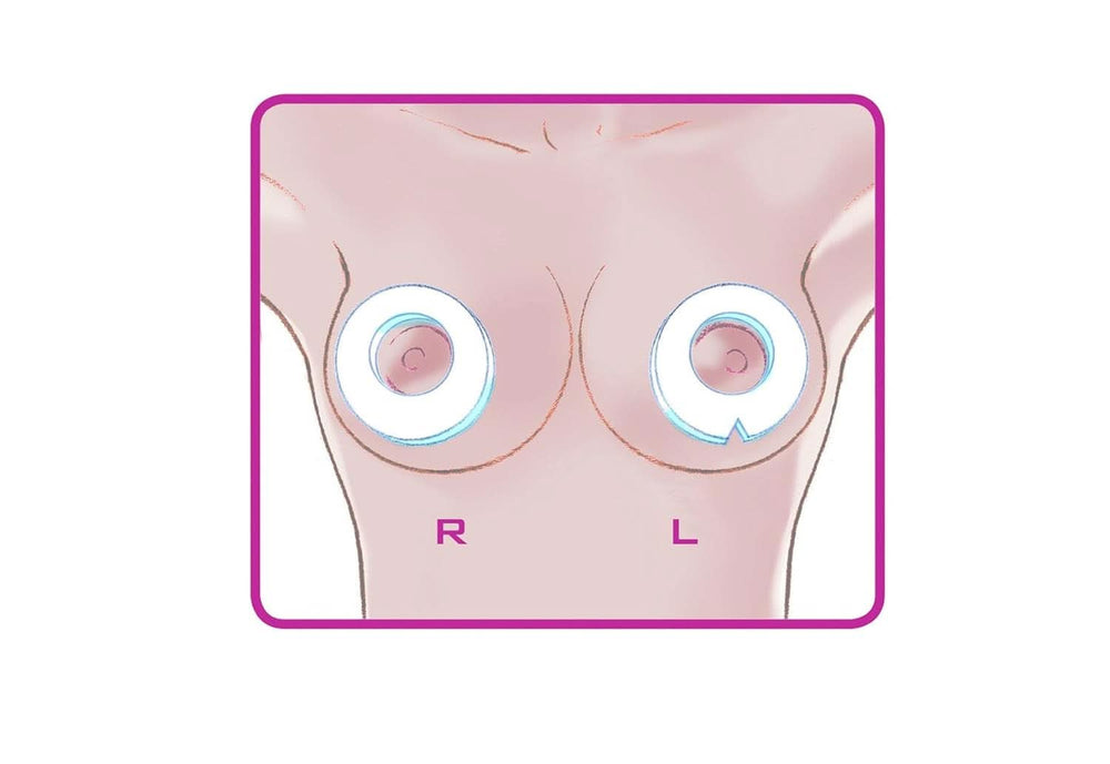 ELANEE Brust-Ringe, Schutz Der Brustwarze Bh-Kontakt Durch Hohllagerung, Ideal Bei Wunden, Entzündeten Brustwarzen Durch Stillen, 10 Stück (222-00) Příslušenství Jídlo a kojení Bebe Naty Shop