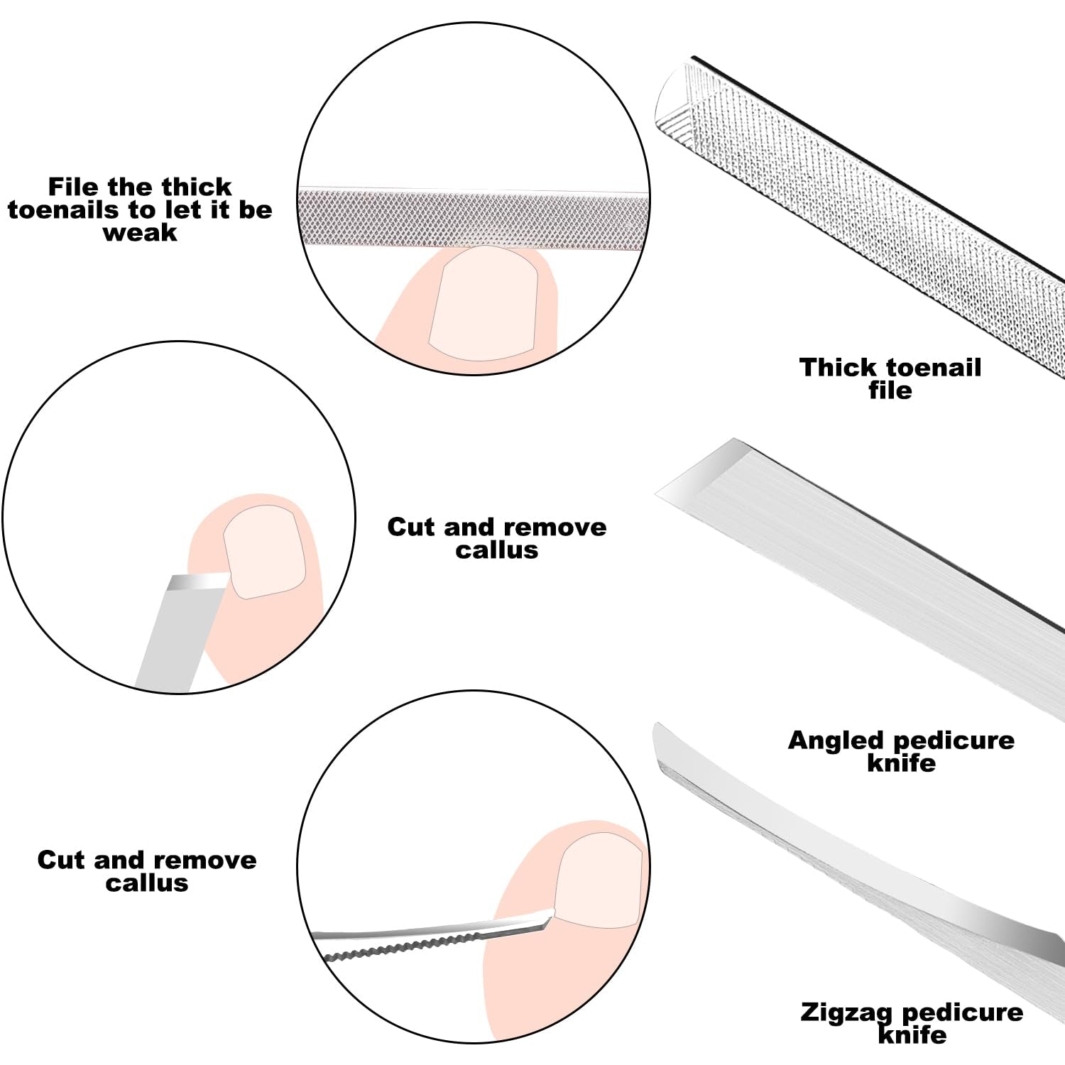 7-Teiliges Set Mit Feilen Und Hebern Für Eingewachsene Zehennägel, Set Aus Edelstahl Zum Entfernen Eingewachsener Zehennägel, Nagelreiniger Für Die Unternagelpflege, Pediküre-Werkzeuge