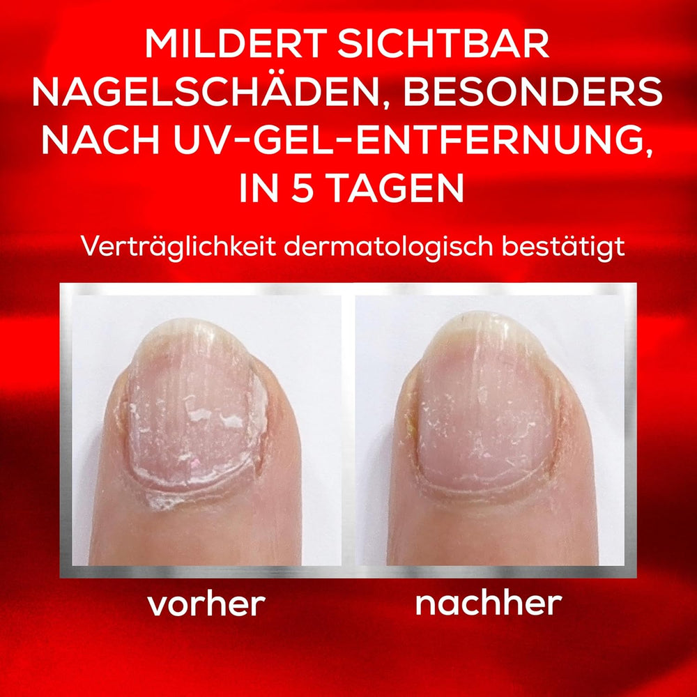 Essie Nail Rescue Kit: Meruňkový vonný olej na nehty a kůžičku + To the Rescue Repair Lak na nehty