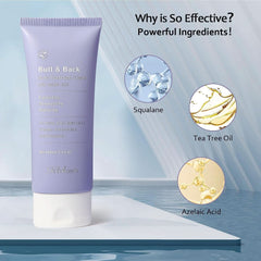 Krém proti akné, 100 ml Kosmetika a kosmetika Naty Shop